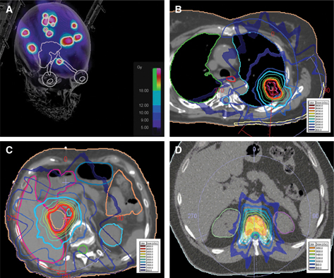 Click to Enlarge View Fig 1