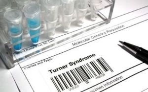 Turner Syndrome illustration