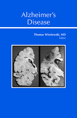 Alzheimer’s Disease book cover