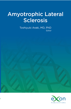 Open access book Amyotrophic Lateral Sclerosis cover