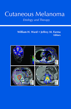 Cutaneous melanoma book cover